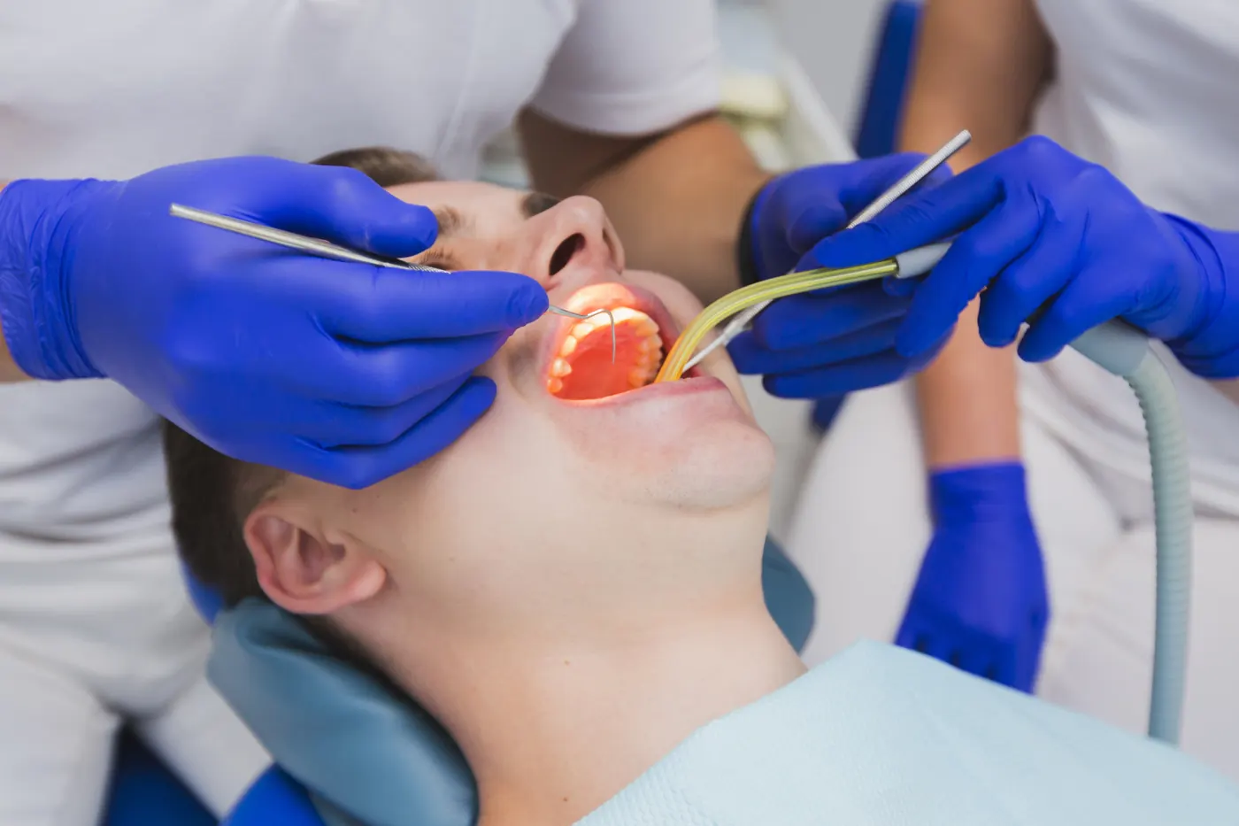 Painless Root Canal Treatment in Chennai: Cost, Procedure & Recovery Guide (2026)